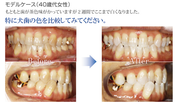 ホワイトニング 診療内容 藤沢市湘南台の歯医者さん 湘南台中央デンタルクリニック
