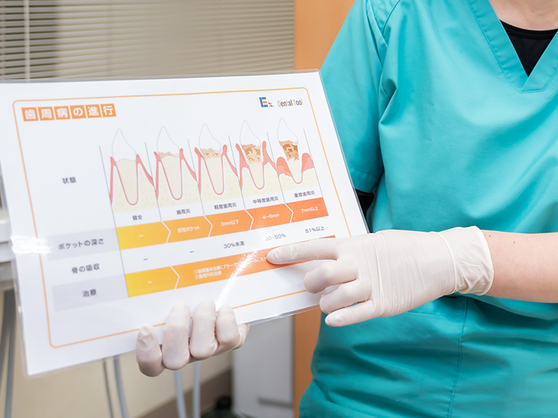 画像をアップロード